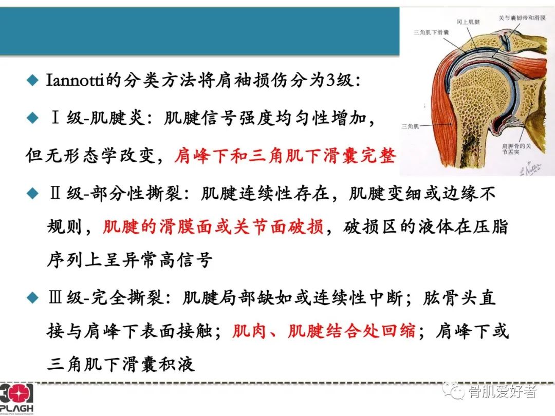 影像PPT - 【PPT】肩关节解剖与运动损伤影像诊断-15