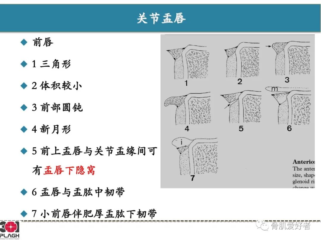 影像PPT - 【PPT】肩关节解剖与运动损伤影像诊断-25