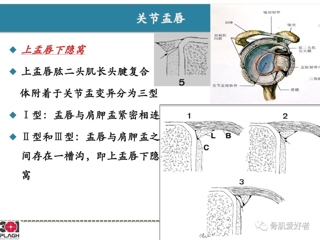 影像PPT - 【PPT】肩关节解剖与运动损伤影像诊断-27