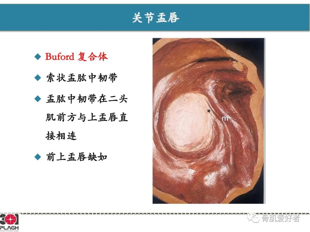 影像PPT - 【PPT】肩关节解剖与运动损伤影像诊断-32