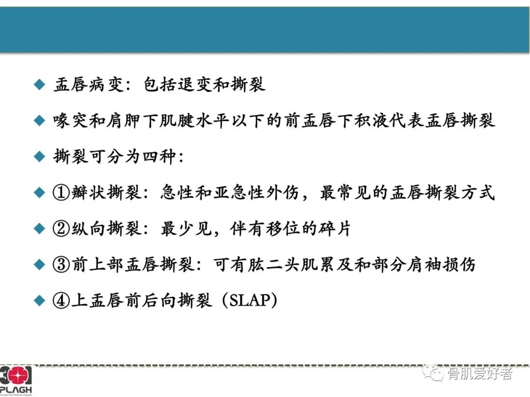 影像PPT - 【PPT】肩关节解剖与运动损伤影像诊断-34