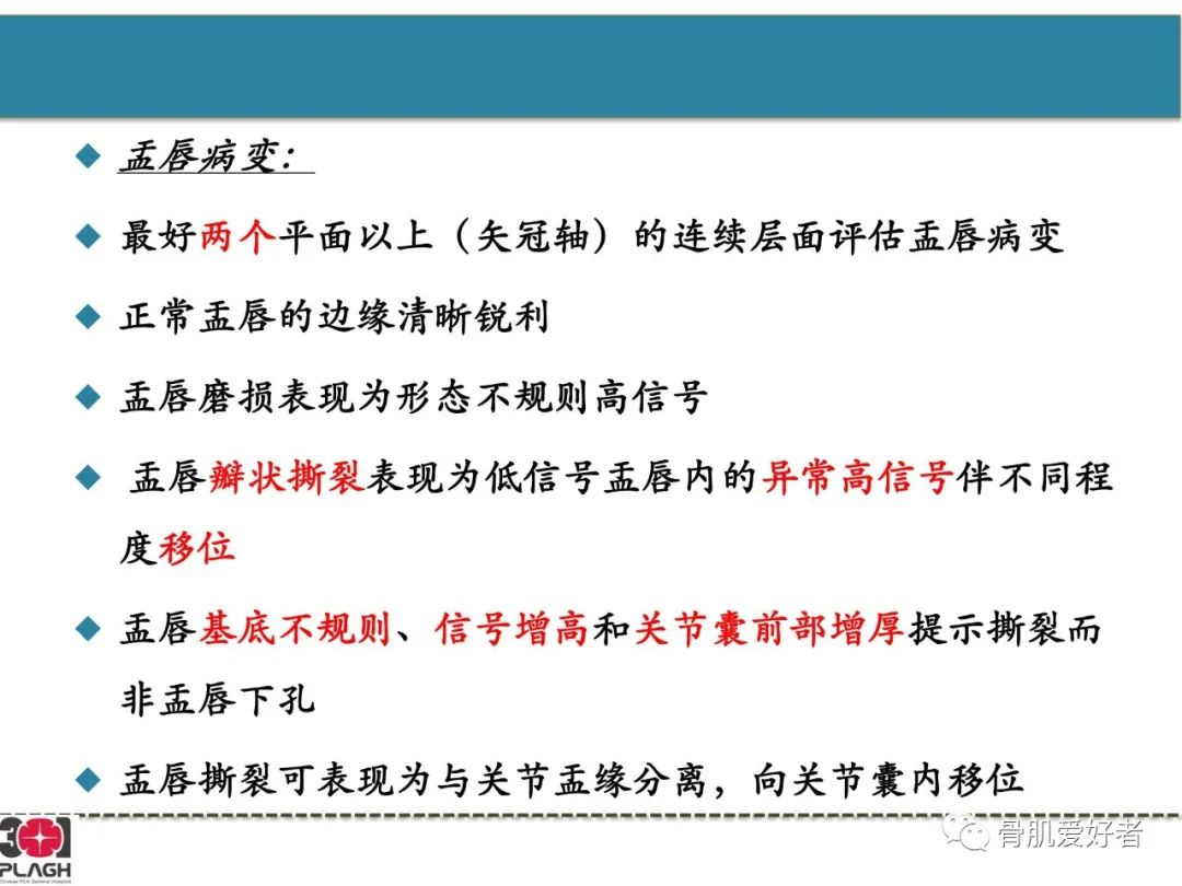 影像PPT - 【PPT】肩关节解剖与运动损伤影像诊断-35