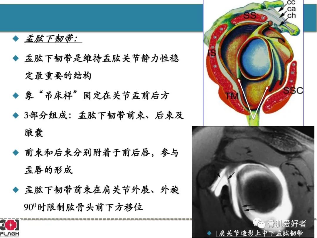 影像PPT - 【PPT】肩关节解剖与运动损伤影像诊断-53