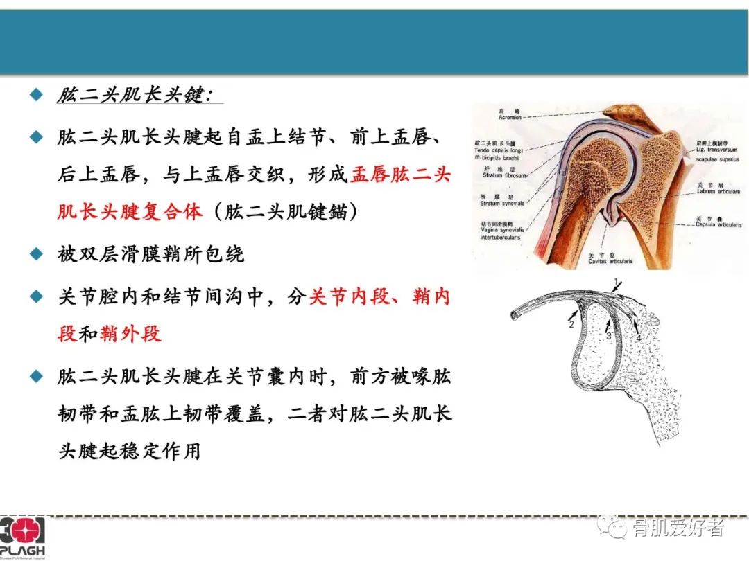影像PPT - 【PPT】肩关节解剖与运动损伤影像诊断-58