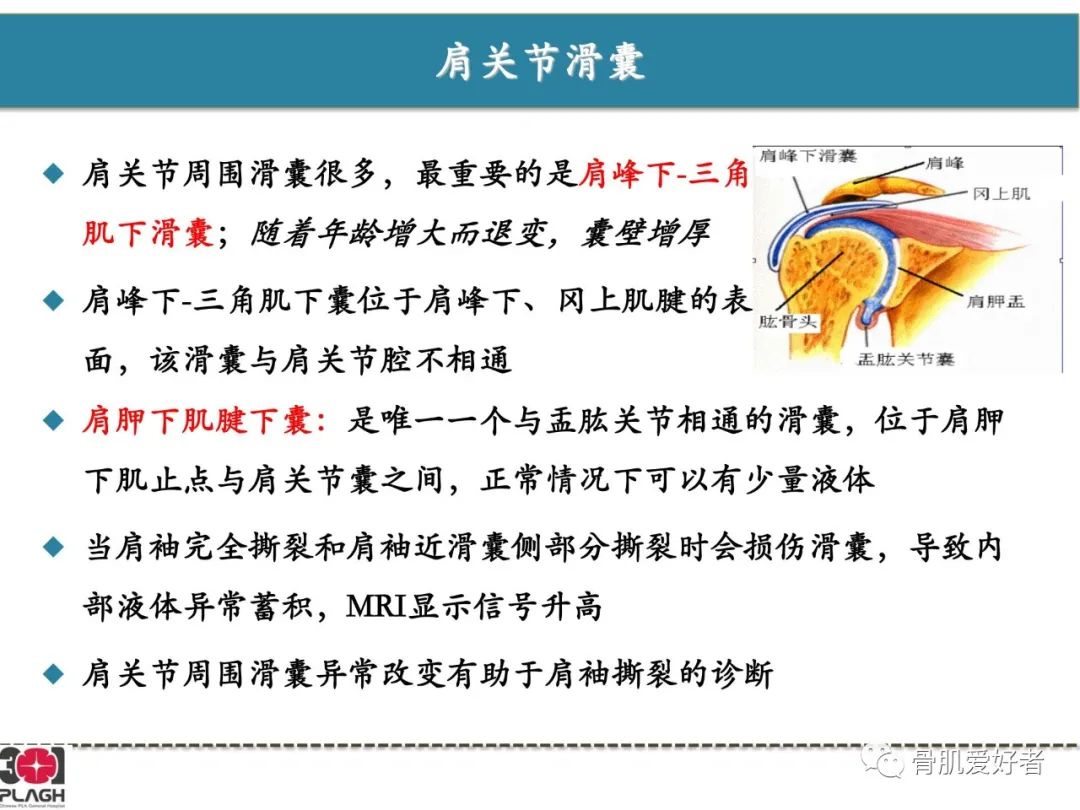 影像PPT - 【PPT】肩关节解剖与运动损伤影像诊断-61