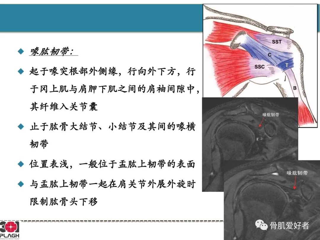 影像PPT - 【PPT】肩关节解剖与运动损伤影像诊断-55