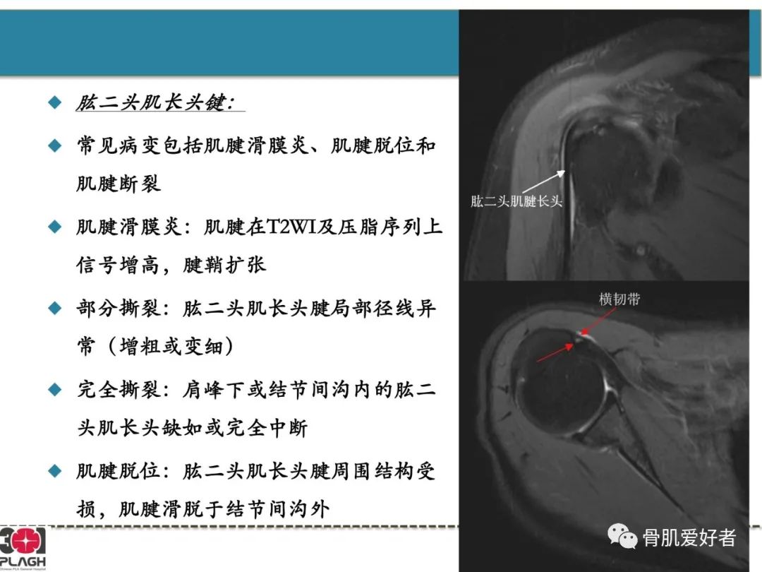 影像PPT - 【PPT】肩关节解剖与运动损伤影像诊断-1