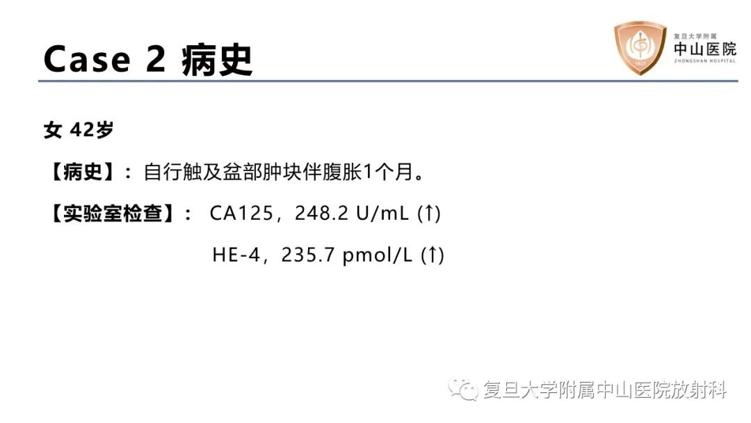 影像PPT - 【病例】卵巢4种上皮源性肿瘤影像鉴别-4