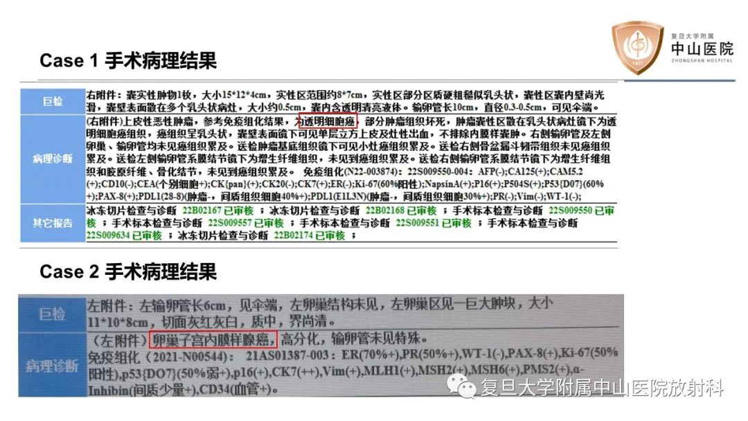 影像PPT - 【病例】卵巢4种上皮源性肿瘤影像鉴别-11