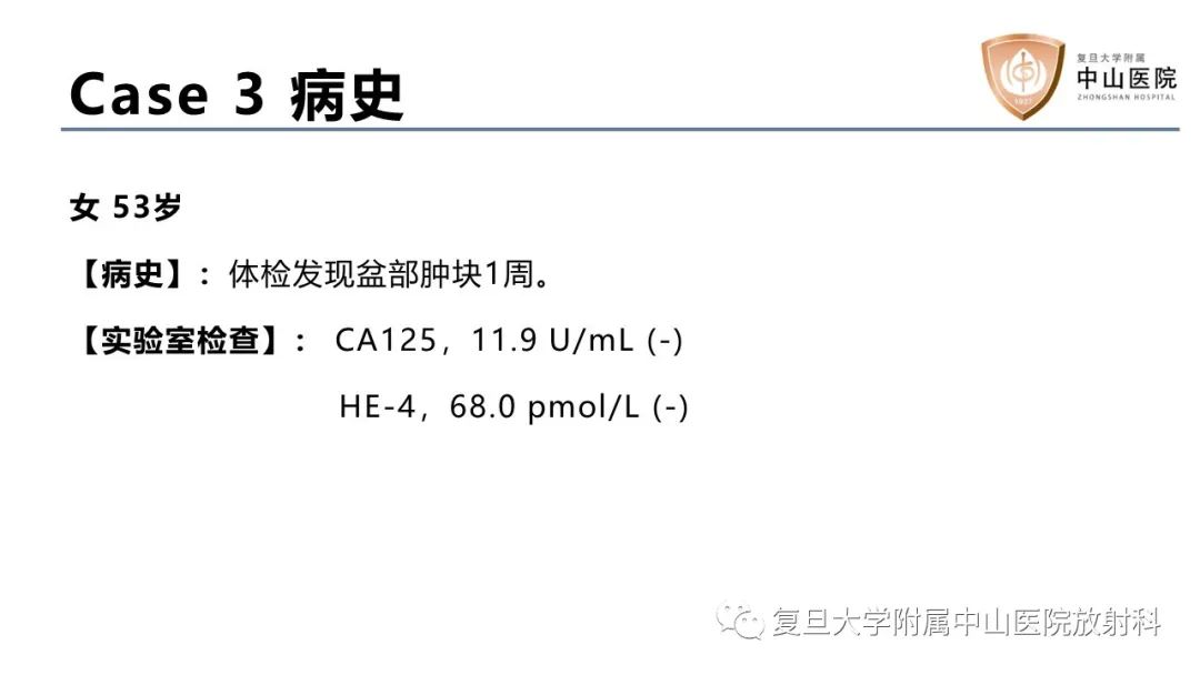 影像PPT - 【病例】卵巢4种上皮源性肿瘤影像鉴别-6