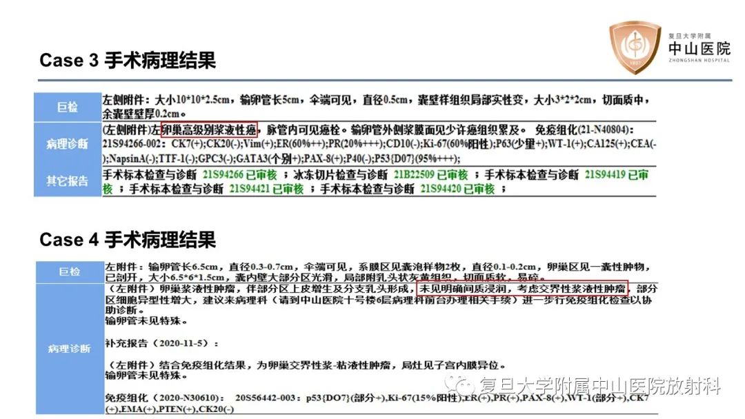 影像PPT - 【病例】卵巢4种上皮源性肿瘤影像鉴别-12