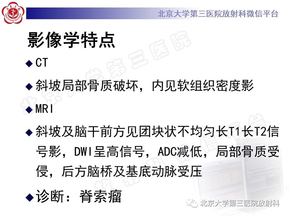 影像PPT - 【PPT】脊索瘤-7