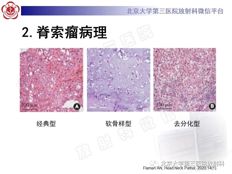影像PPT - 【PPT】脊索瘤-11