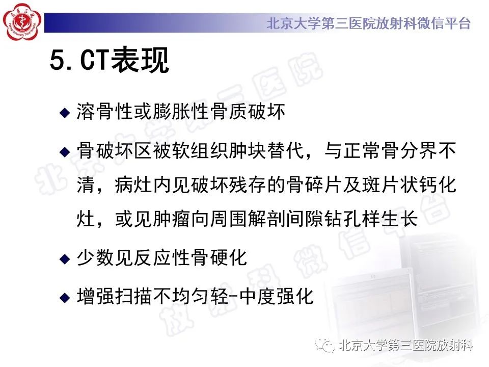影像PPT - 【PPT】脊索瘤-16
