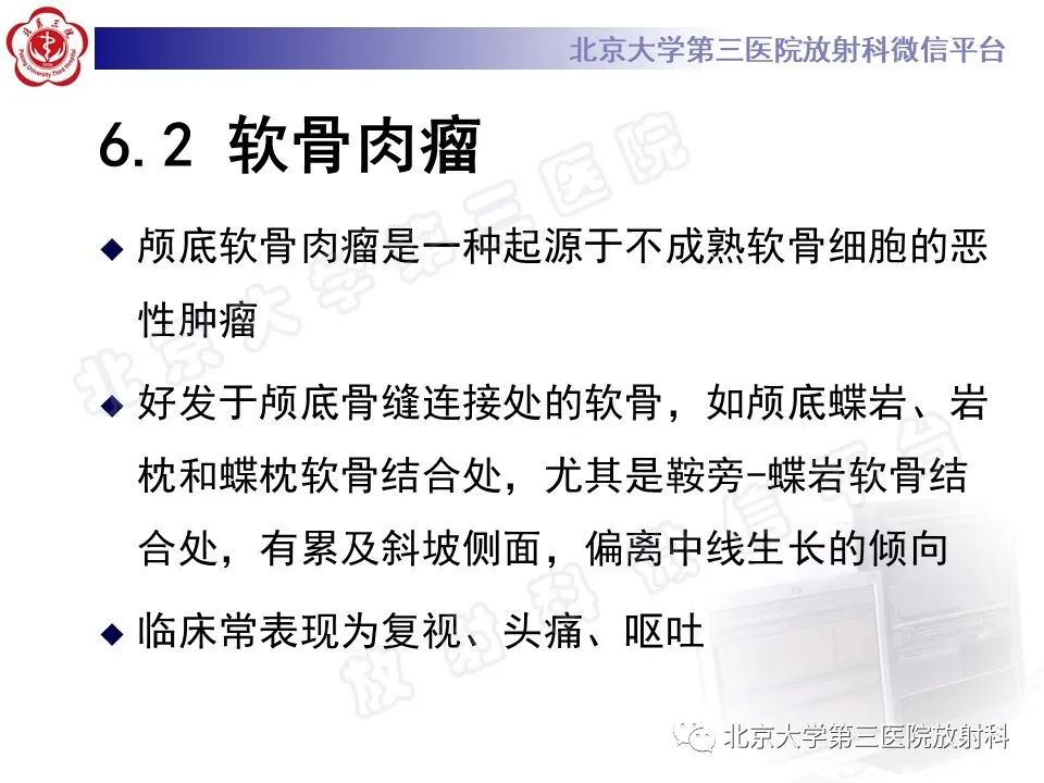 影像PPT - 【PPT】脊索瘤-21