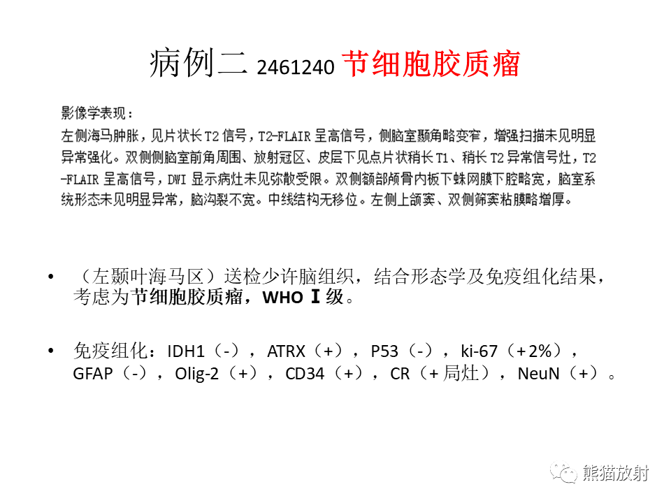 影像PPT - 【PPT】颅内节细胞胶质瘤2例MR影像-25