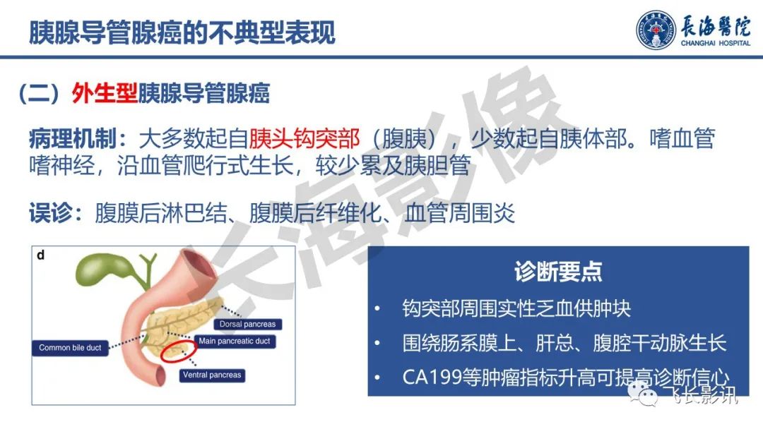影像PPT - 【PPT】胰腺常见肿瘤的不典型影像表现—实战病例解析-12