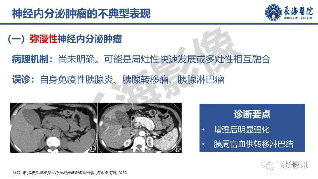 影像PPT - 【PPT】胰腺常见肿瘤的不典型影像表现—实战病例解析-24