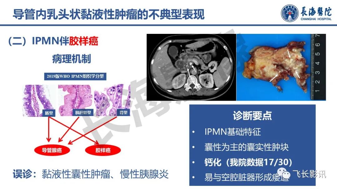 影像PPT - 【PPT】胰腺常见肿瘤的不典型影像表现—实战病例解析-34