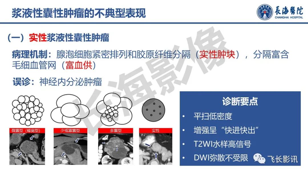 影像PPT - 【PPT】胰腺常见肿瘤的不典型影像表现—实战病例解析-36
