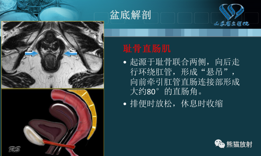 影像PPT - 【PPT】盆底解剖与肛周病变的MRI表现-5