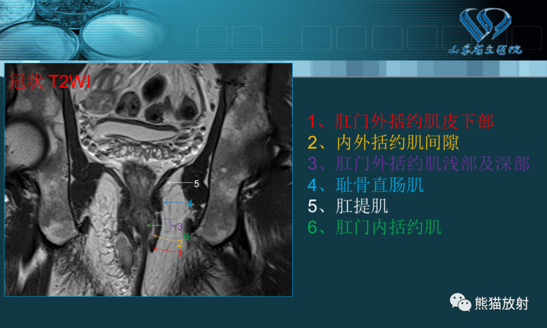 影像PPT - 【PPT】盆底解剖与肛周病变的MRI表现-9