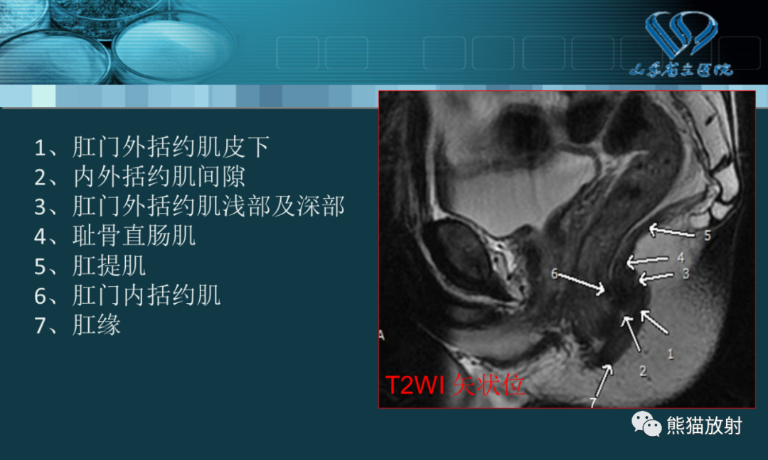 影像PPT - 【PPT】盆底解剖与肛周病变的MRI表现-10