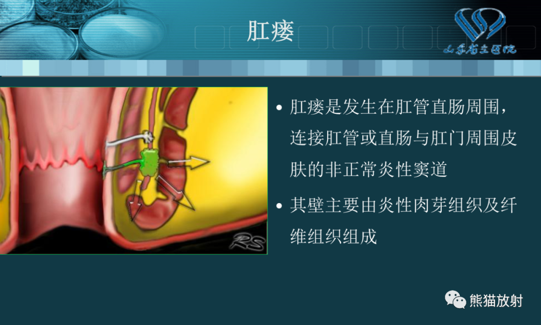 影像PPT - 【PPT】盆底解剖与肛周病变的MRI表现-12