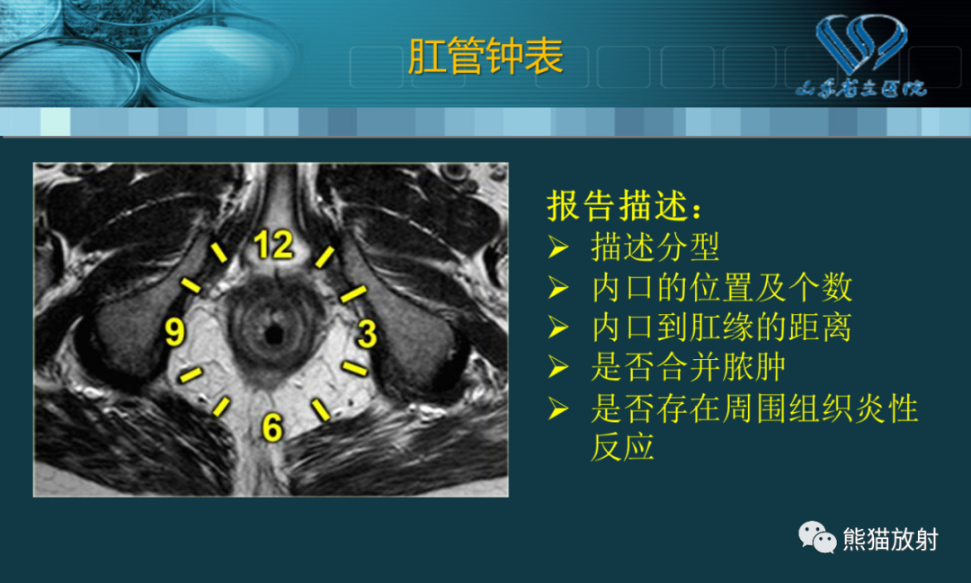 影像PPT - 【PPT】盆底解剖与肛周病变的MRI表现-32