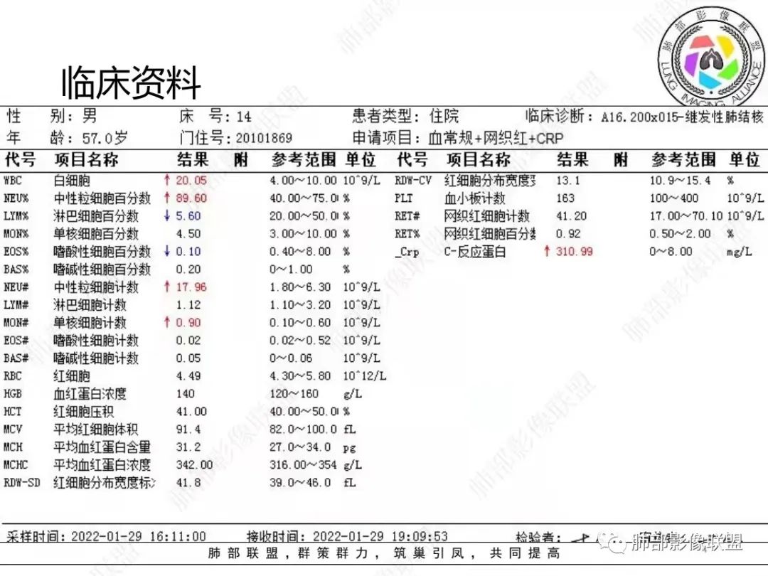 影像PPT - 【病例】糖尿病+多发结节、树芽影，你如何诊断？-4