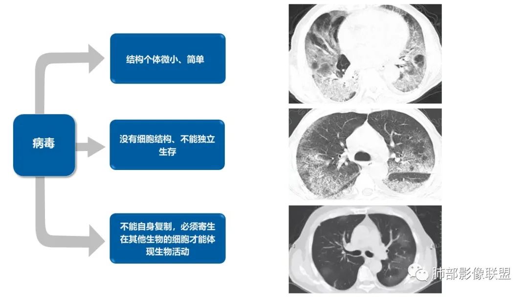 影像PPT - 【病例】糖尿病+多发结节、树芽影，你如何诊断？-24