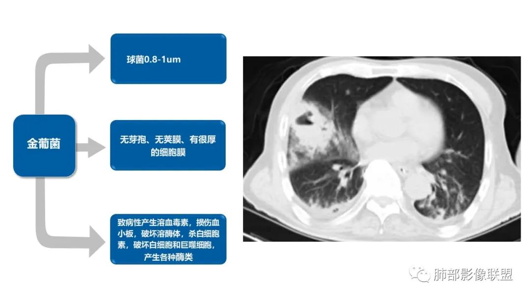 影像PPT - 【病例】糖尿病+多发结节、树芽影，你如何诊断？-25