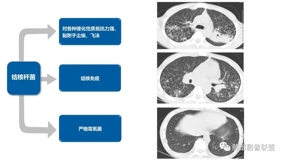 影像PPT - 【病例】糖尿病+多发结节、树芽影，你如何诊断？-23