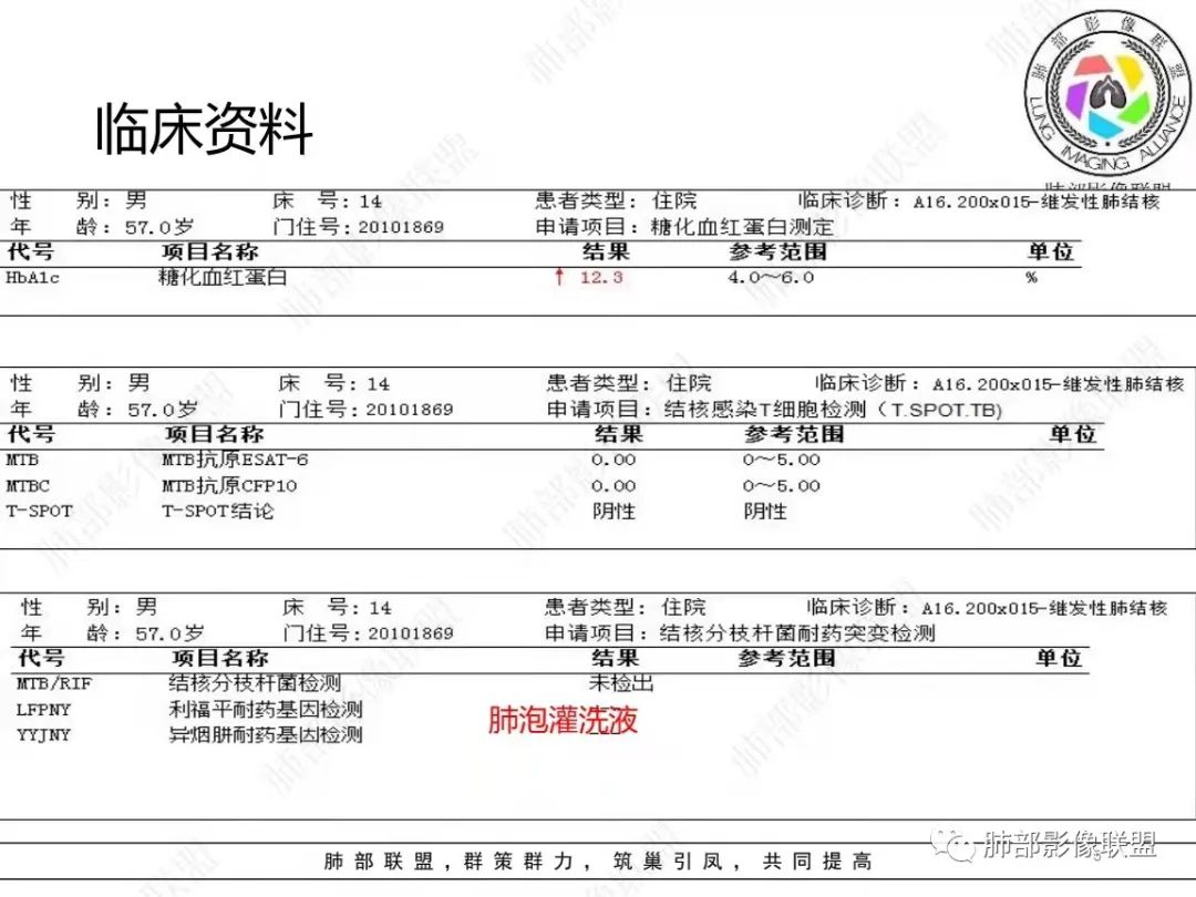 影像PPT - 【病例】糖尿病+多发结节、树芽影，你如何诊断？-1