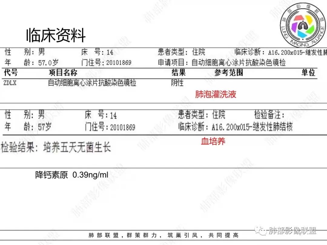 影像PPT - 【病例】糖尿病+多发结节、树芽影，你如何诊断？-2