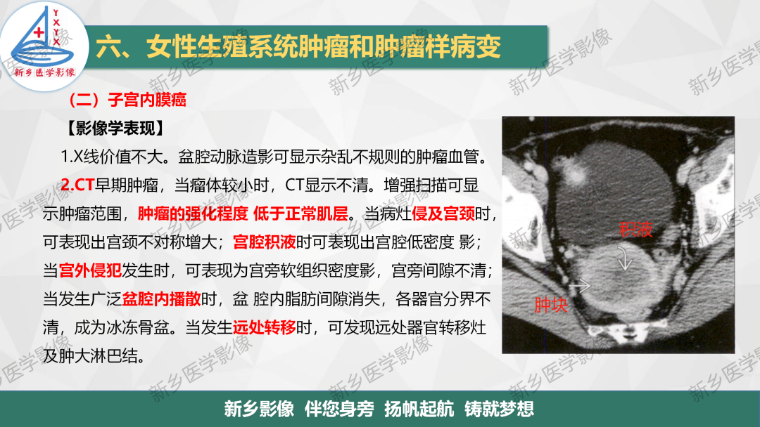 影像PPT - 【PPT】子宫内膜癌分期的影像表现-4