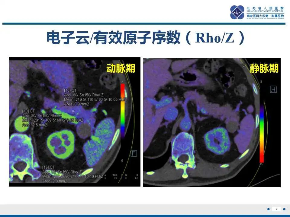 影像PPT - 【PPT】胰腺内异位副脾-6