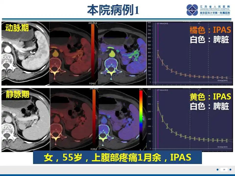 影像PPT - 【PPT】胰腺内异位副脾-26