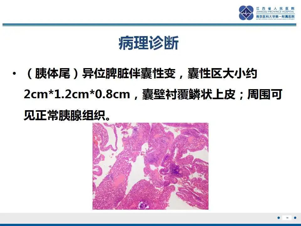 影像PPT - 【PPT】胰腺内异位副脾-16