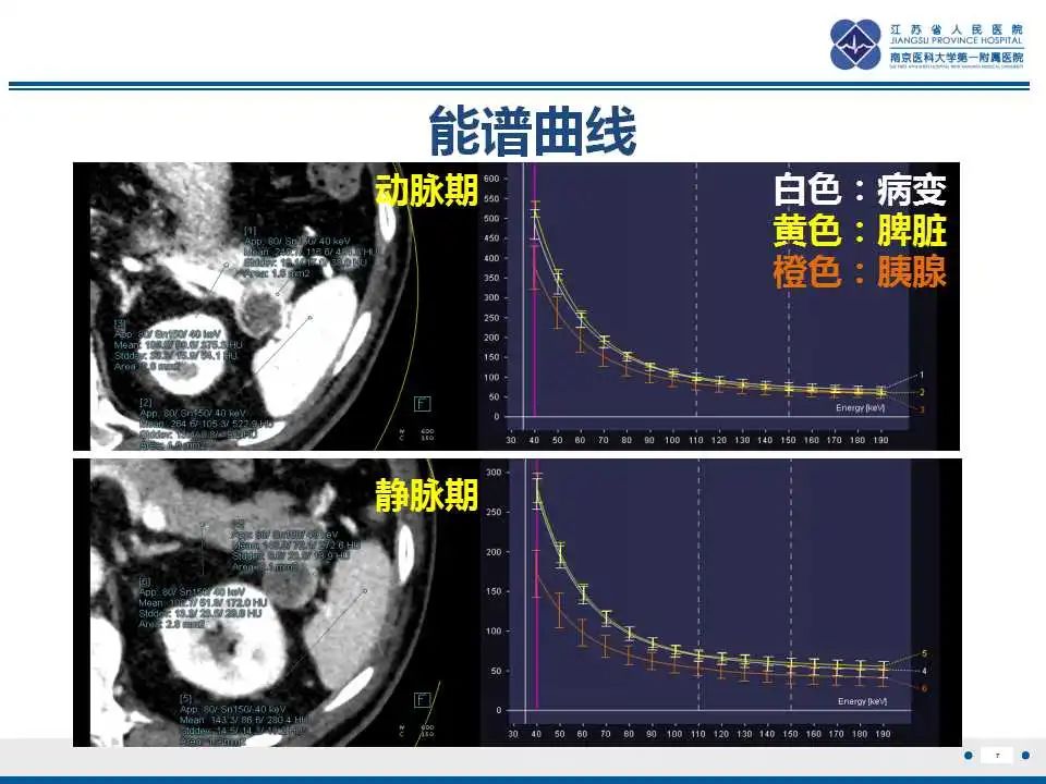影像PPT - 【PPT】胰腺内异位副脾-7