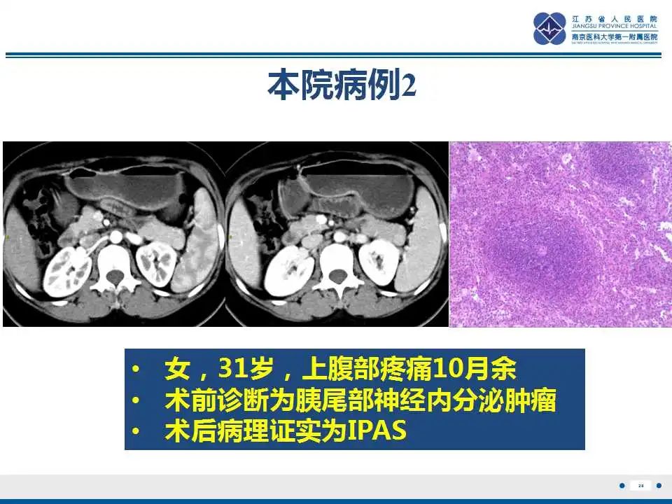 影像PPT - 【PPT】胰腺内异位副脾-28