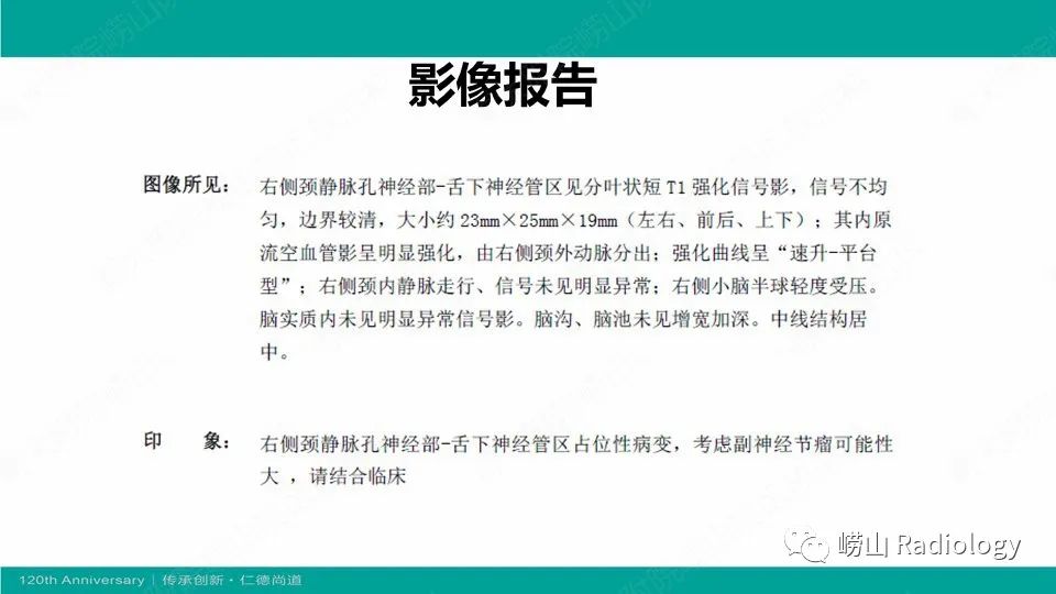 影像PPT - 【病例】颈静脉孔区副神经节瘤(颈静脉球瘤)1例CT及MR-21