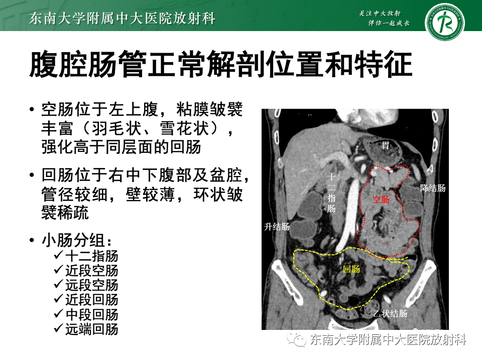 影像PPT - 【PPT】肠旋转不良-14 影像PPT - 【PPT】肠旋转不良-14