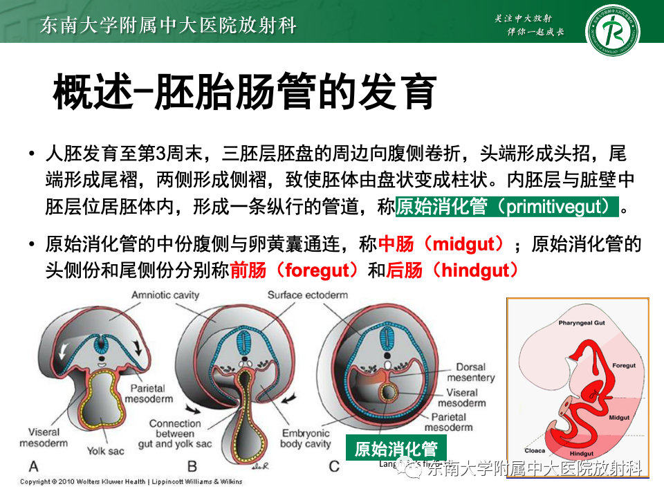 影像PPT - 【PPT】肠旋转不良-8 影像PPT - 【PPT】肠旋转不良-8