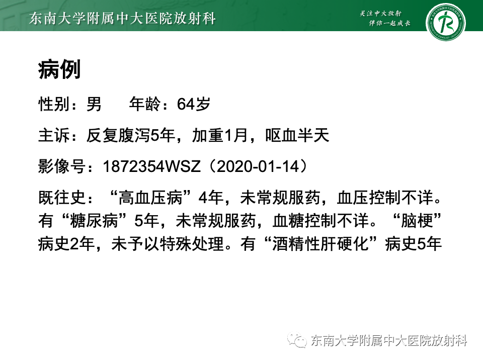 影像PPT - 【PPT】肠旋转不良-23 影像PPT - 【PPT】肠旋转不良-23