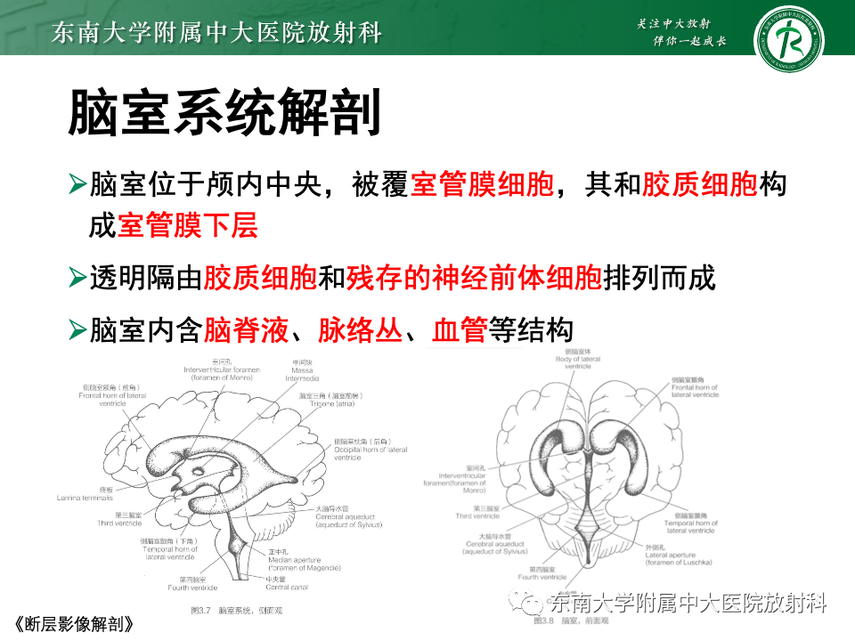 影像PPT - 【PPT】中枢神经细胞瘤-6 影像PPT - 【PPT】中枢神经细胞瘤-6