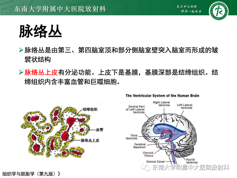 影像PPT - 【PPT】中枢神经细胞瘤-7 影像PPT - 【PPT】中枢神经细胞瘤-7