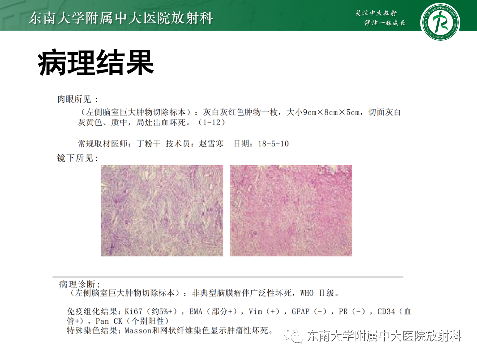 影像PPT - 【PPT】中枢神经细胞瘤-35 影像PPT - 【PPT】中枢神经细胞瘤-35