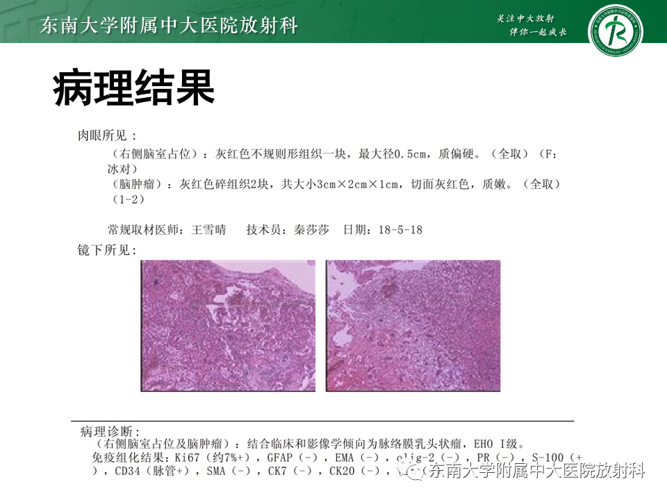 影像PPT - 【PPT】中枢神经细胞瘤-29 影像PPT - 【PPT】中枢神经细胞瘤-29