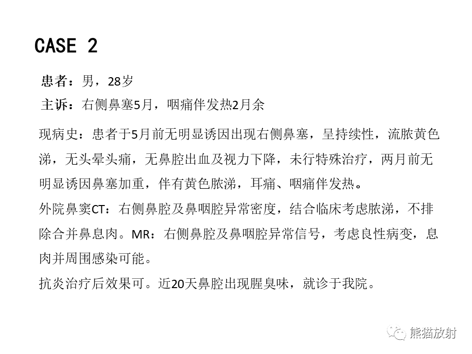 影像PPT - 【病例】鼻腔鼻窦淋巴瘤2例-10